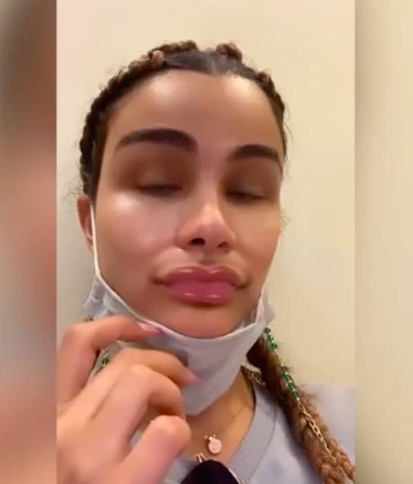 The face of the driver causes controversy (IG)