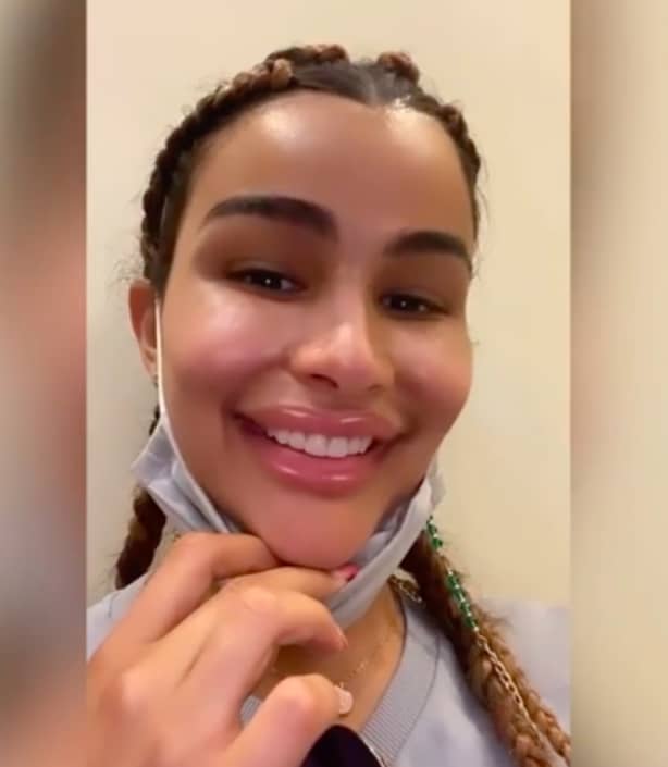 Clarissa Molina face (IG)