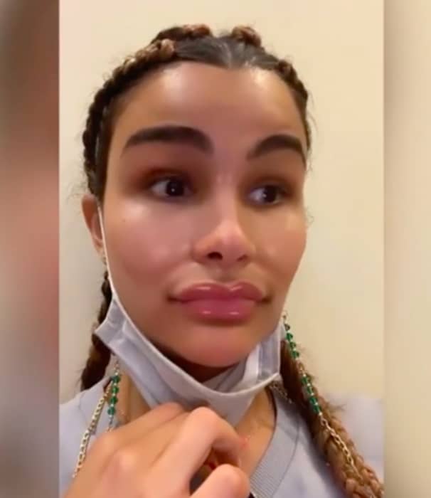 Disfigured from her body? Clarissa Molina hits (IG)
