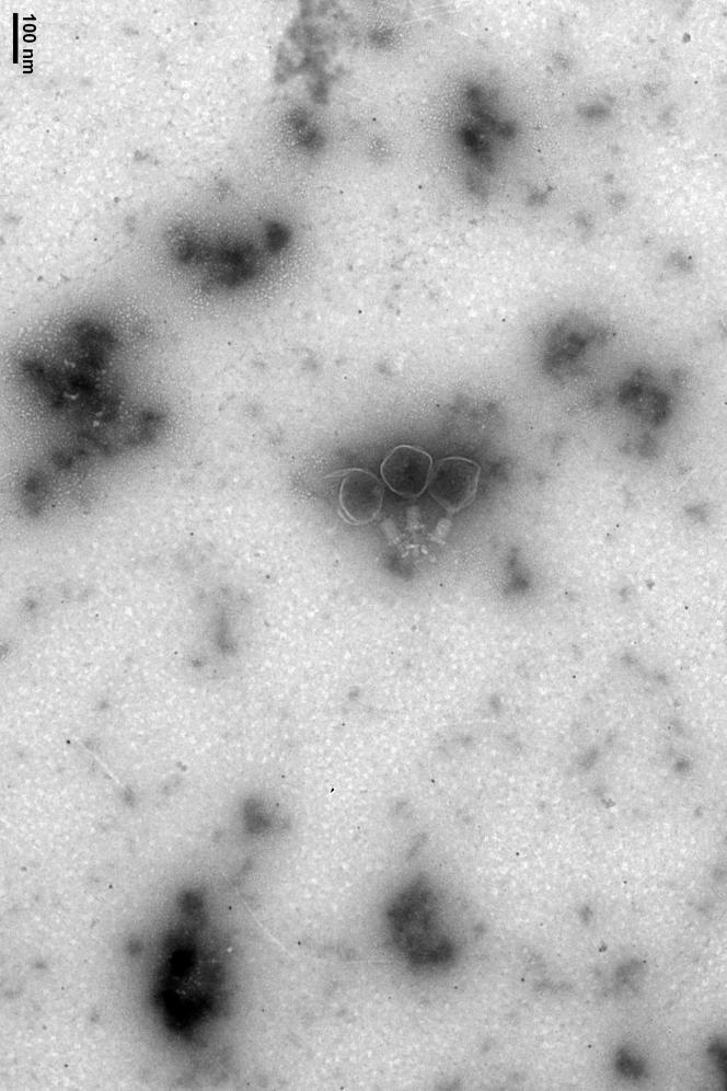 Three anti “Staphylococcus aureus” phages seen by electron microscopy.