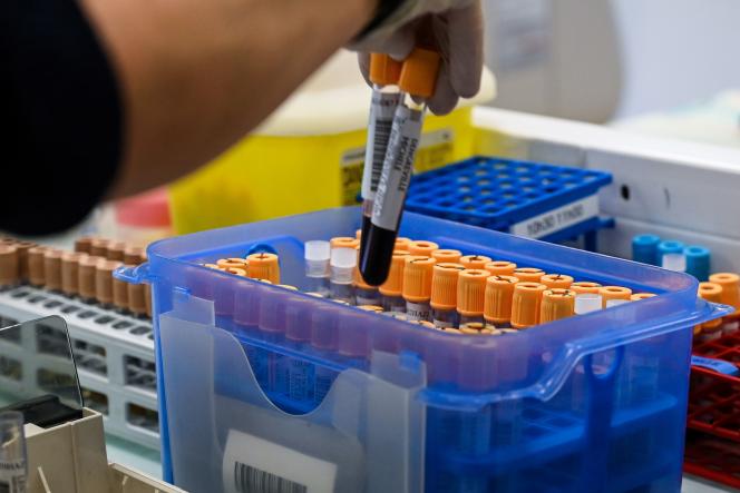 Blood samples, on June 9, 2020, in a clinical laboratory in Hazebrouck, in the north of France.
