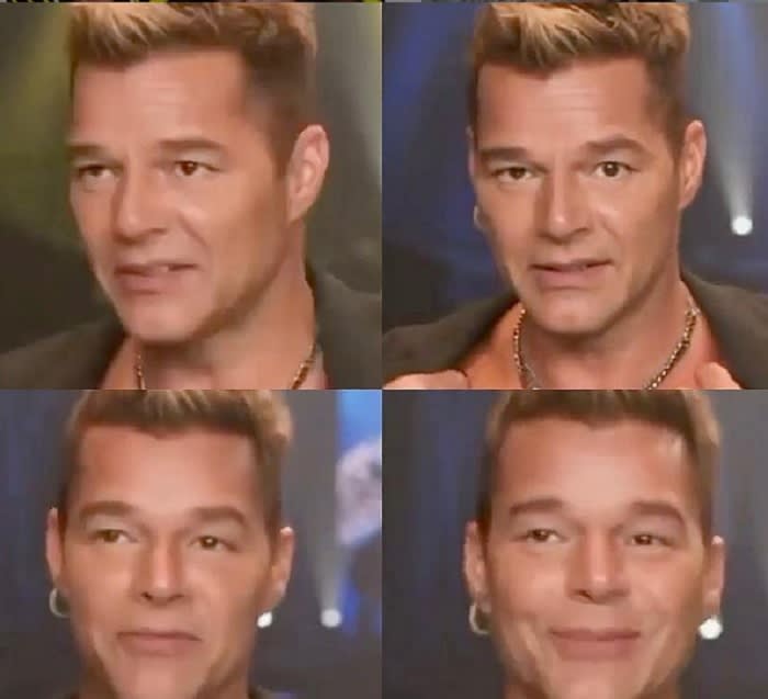 "Ricky Martin did not have any cosmetic surgery"