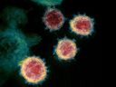 This undated transmission electron microscope image shows SARS-CoV-2, also known as novel coronavirus, the virus that causes COVID-19, isolated from a patient in the US Virus particles are shown emerging from the surface of cells grown in the laboratory.  Spikes on the outer edge of virus particles give coronaviruses their name, in the shape of a corona.