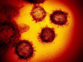 This undated electron microscope image made available by the US National Institutes of Health in February 2020 shows the novel SARS-CoV-2 coronavirus.