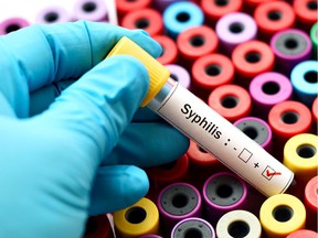 jarun011 / iStock / Getty Images Plus Stock Photo of Syphilis ORG XMIT: POS1905031328470811