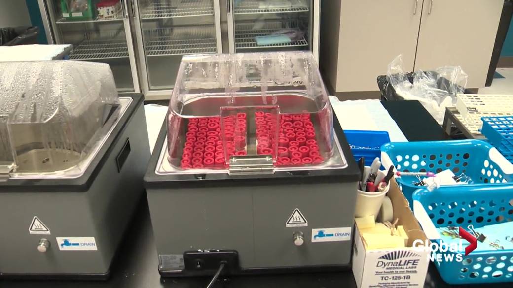 Click to play video: 'Health Matters: Where does your COVID-19 swab go?  A tour inside the DynaLIFE lab '