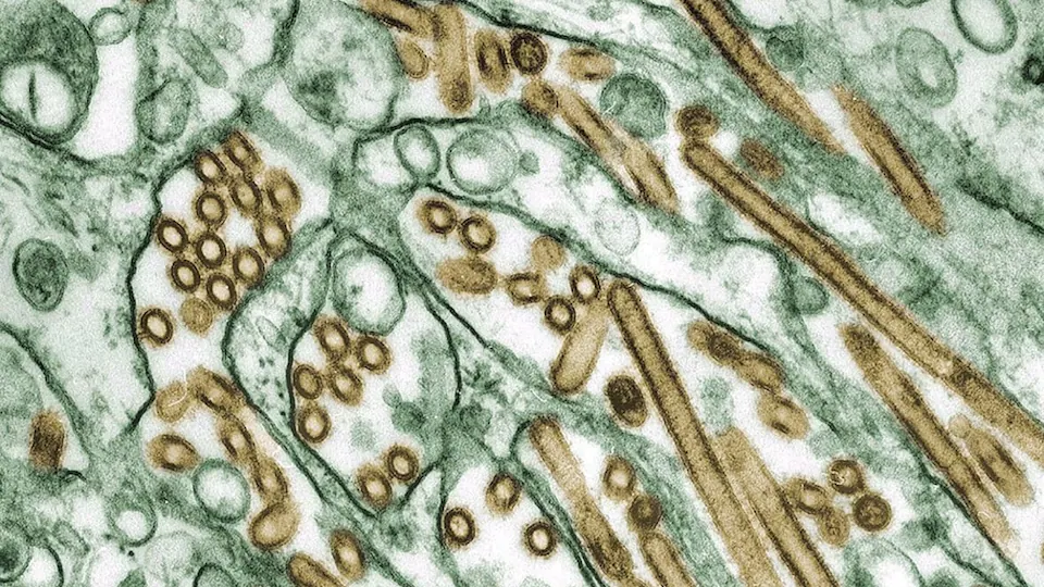 Une image de cellules de la grippe aviaire