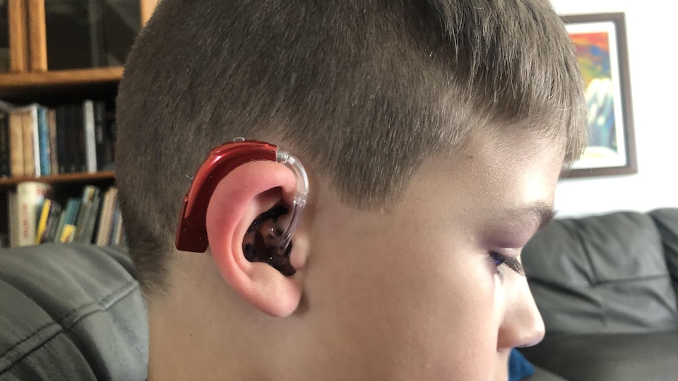A 9-year-old child wears a hearing aid.