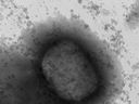 An electronic microscope image shows the monkeypox virus in Madrid, Thursday May 26, 2022.